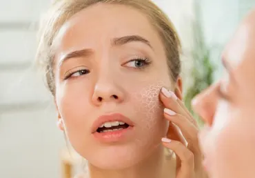 Peau seche Peau sèche